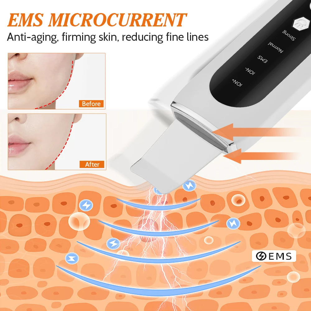 Ultrasonic Facial Pore Cleaner